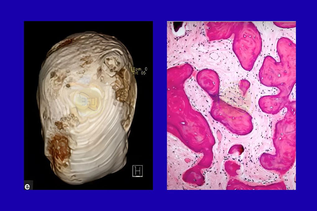 OM360_COURSE_FibroOsseous_2025